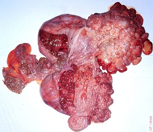Cystic Placental Mole.
