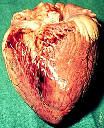 Bruised Heart.