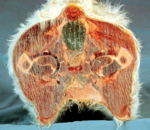 Cross Section of the Fetus at the Hips.