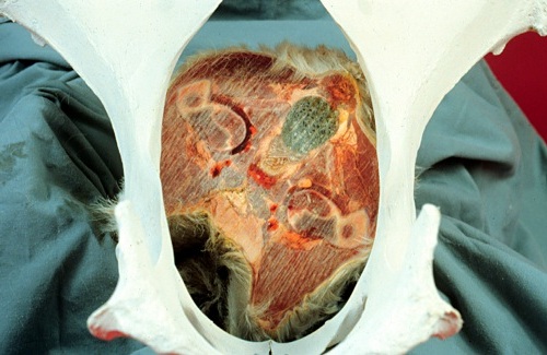 Rotation of the Fetal Pelvis.