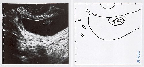 Day 27 Embryo / Ultrasound.