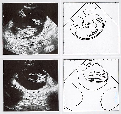 Day 59 Fetus / Ultrasound.