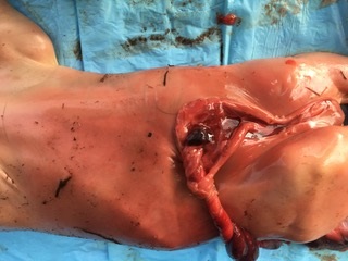 Umbilical torsion in a bovine fetus.