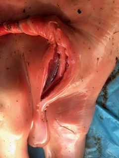 Umbilical torsion in a bovine fetus.  Picture 4 of 4.
