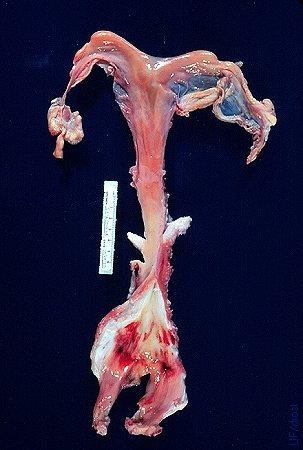 Freemartin - Infantile Reproductive Tract.