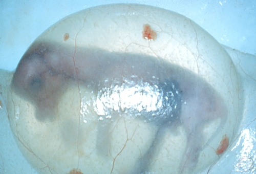 Amniotic Vesicle.