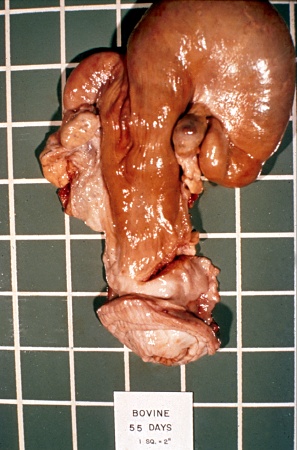 Pregnant Uterus - 55 Days.