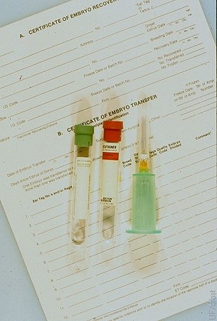 Blood Typing the Donor.