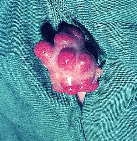Superovulated Ovary on Day 7.