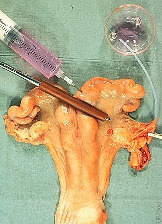 Oviductal Catheter Placement.