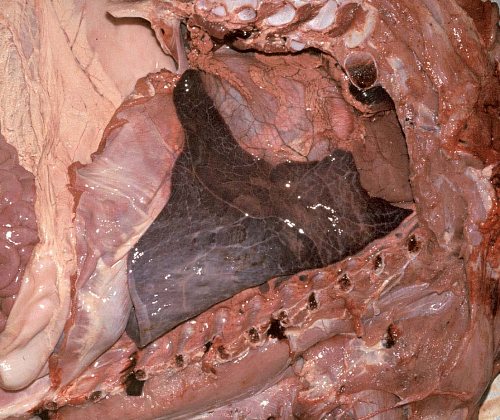 Normal Noninflated Neonatal Lung.