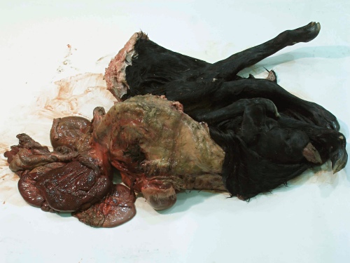 Schistosomus Reflexus / Fetal Death.