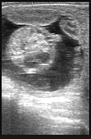 Male Fetus.