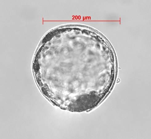 IVF Hatching Blastocyst.