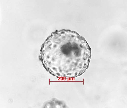 IVF Expanded Hatched Blastocyst.