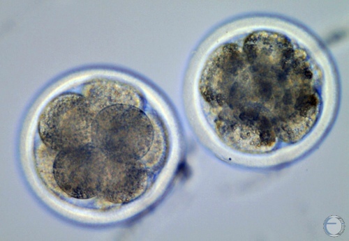 Day 4 to 5 IVF Embryos.