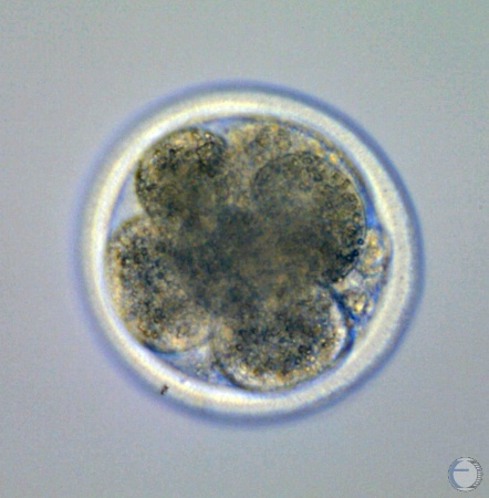 Day 4 to 5 IVF Embryo.