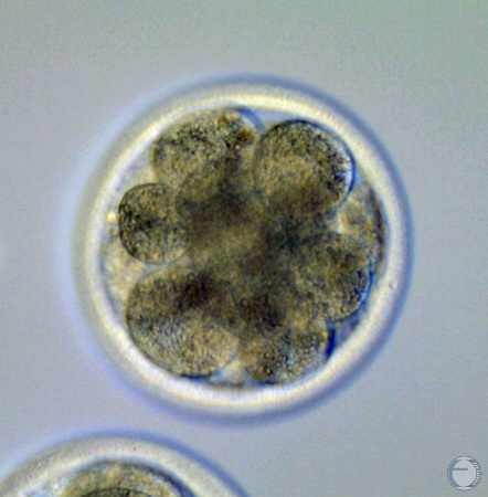 16-cell IVF Embryo.