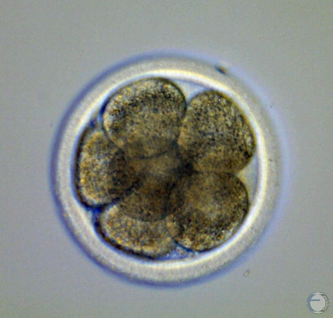 8-cell IVF Embryo.