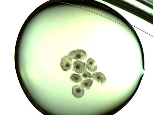 Mature Oocytes in Drop.