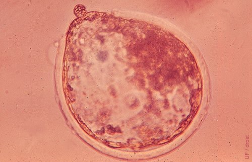 Hatching Blastocyst.