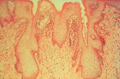 Epithelial Crypts in the Preputial Lining of the Bull.