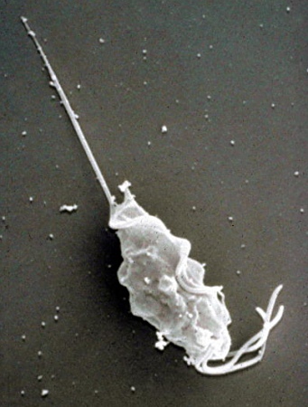 Scanning Electron Micrograph of T Foetus.