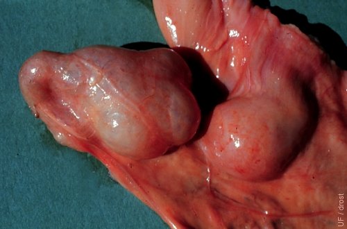 Ovarian Adhesions.