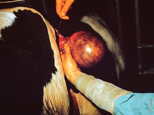 Surgical Removal of a GCT.