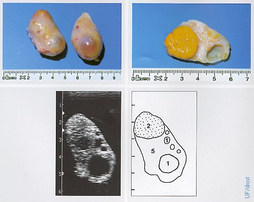 Ovaries on Day 17 of the Estrous Cycle.