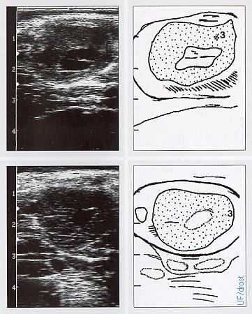 Ovaries on Days 7 and 10.