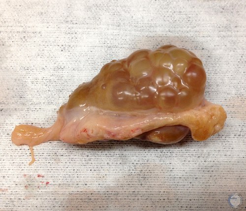 Superovulated Ovary.