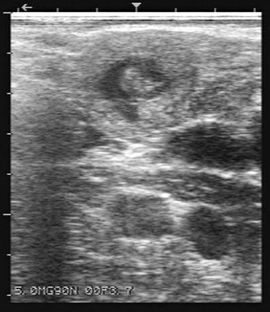 31-Day Pregnancy / Uterus.