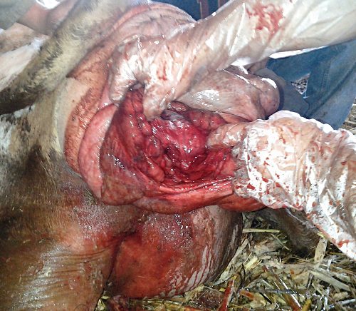 Prolapsed Uterus and a Double Cervix.