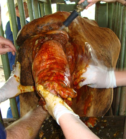 Cleaning of the Cervicovaginal Prolapse.