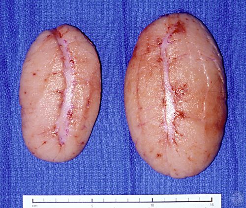 Different Size Testes.