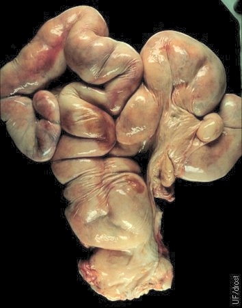 Lymphosarcoma of the Uterus.