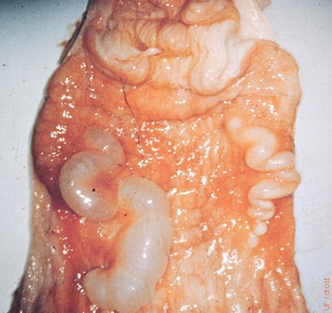 Mesonephric Duct Cysts.