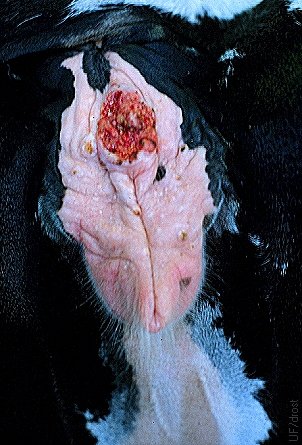 Squamous Cell Carcinoma of the Vulva.
