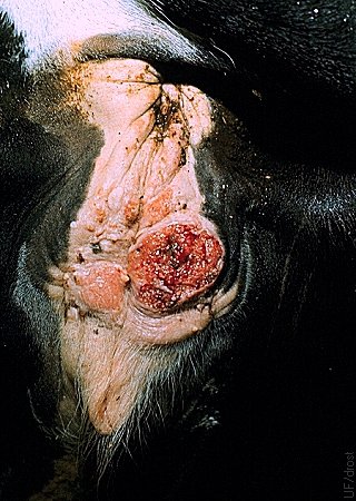 Squamous Cell Carcinoma of the Vulva.