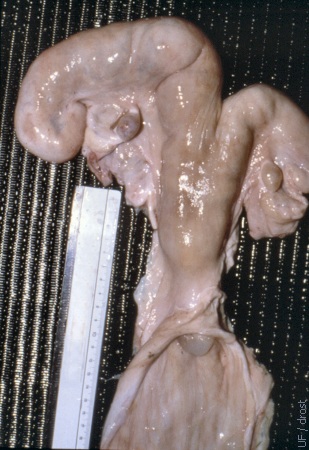 Early Pregnant Uterus.