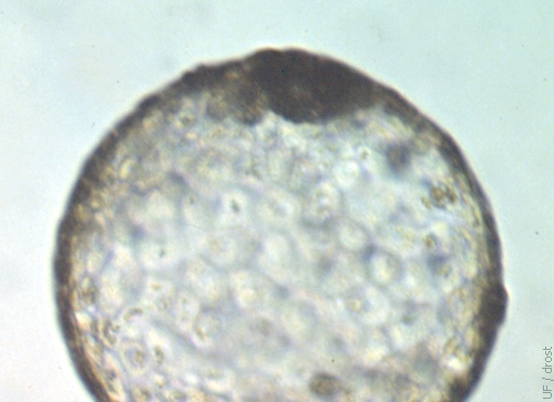 Expanded Hatched Blastocyst.