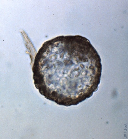 Reconstituted Hatched Blastocyst.