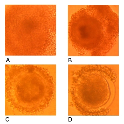 Classification of Recovered Oocytes.
