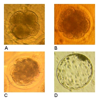 Stages of IVF Embryo Development.