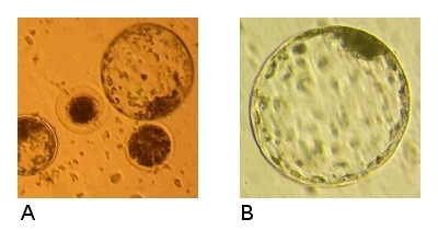 Expansion of Parthenogenic Blastocyst.