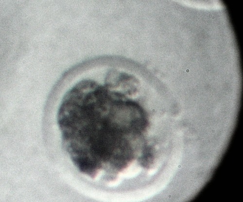 Vitrified IVF Morula.