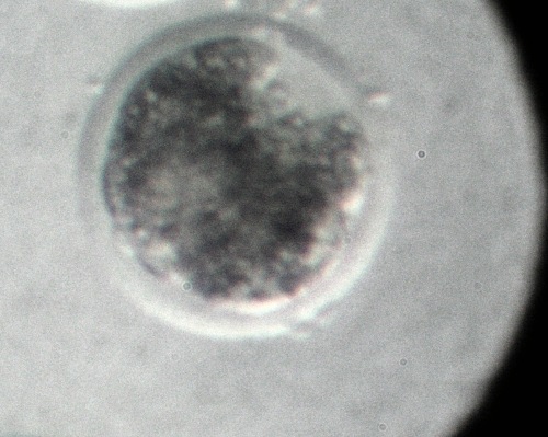 Vitrified IVF Blastula.