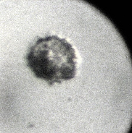 Vitrified IVF Blastula.