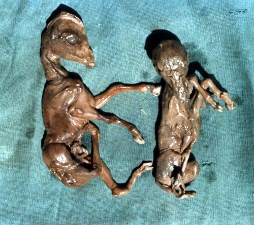 Twin Mummies.